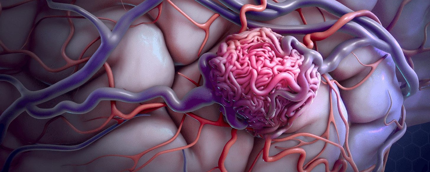AVM Awareness Month header graphic for an article on brain arteriovenous malformations by Dr. Betsy Grunch