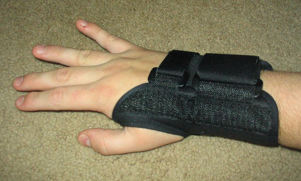 A wrist splint used for carpal tunnel syndrome