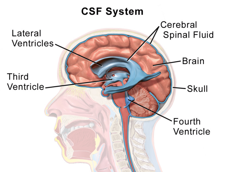 Illustration of the ventricles of the brain and how cerebrospinal fluid flows