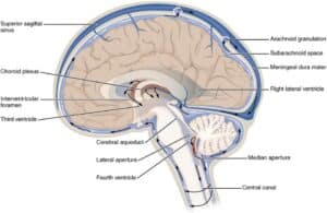 Illustration of how cerebrospinal fluid flows through the ventricles and around the brain and spinal cord
