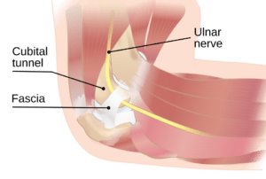 Illustration of the ulnar nerve passing through the cubital tunnel at the inside of the elbow