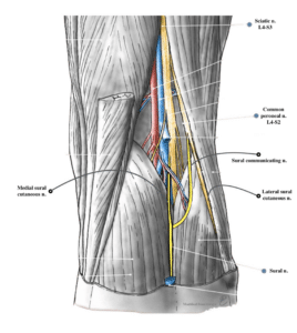 Anatomical drawing of the back of the knee and calf showing the common peroneal nerve and the nerves that form the sural nerve