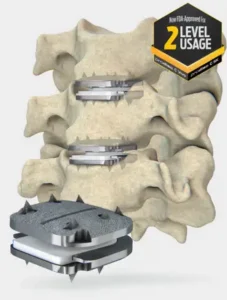 Illustration of two prodisc C artificial discs placed at two levels of the neck, with a close-up of the implant