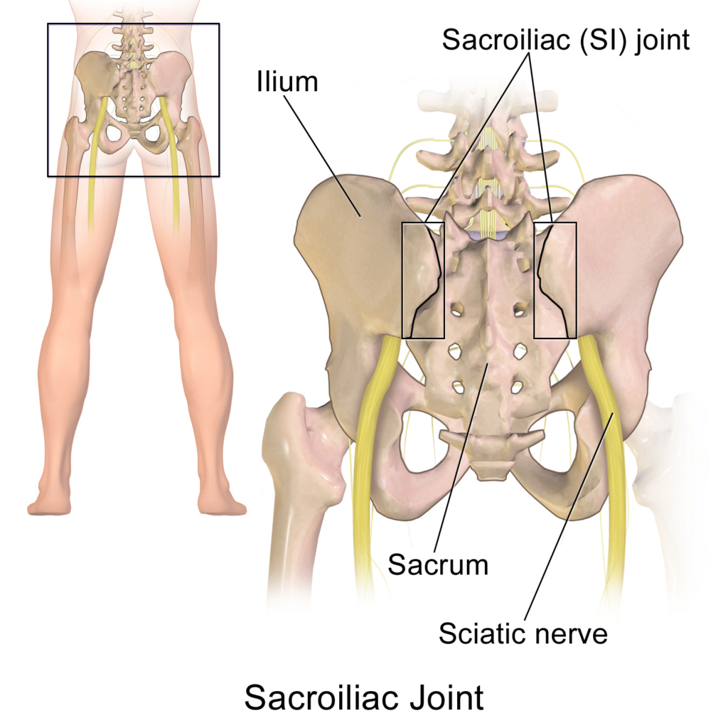 Illustration of the sacroiliac joints where the spine meets the pelvis