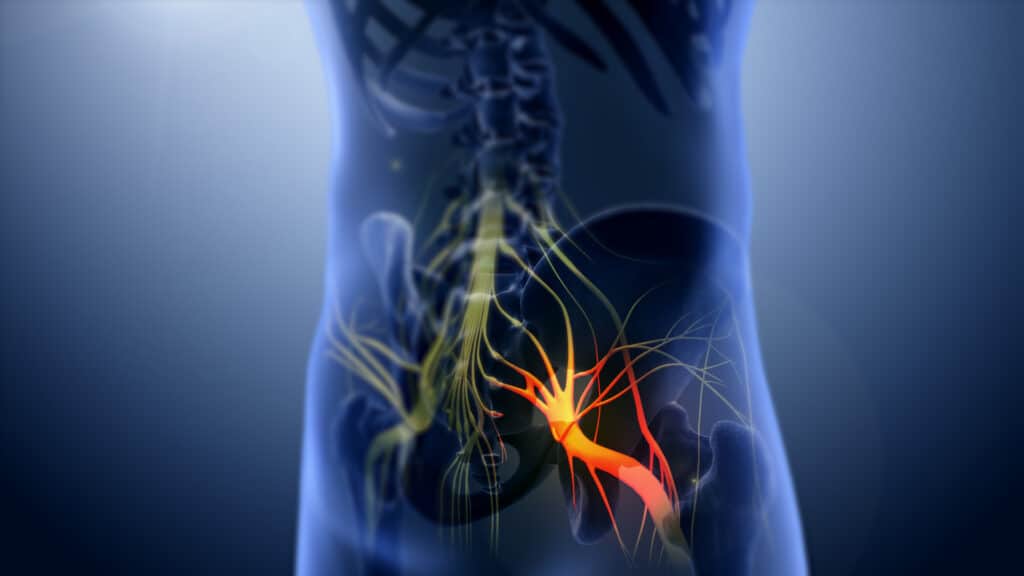 3D illustration of the sciatic nerve running from the lower back down the leg