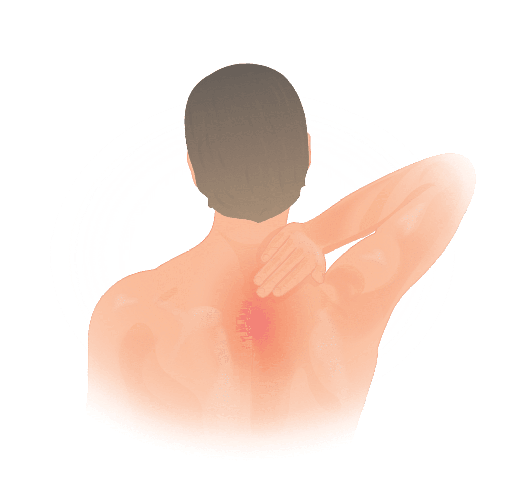 Illustration of upper and mid-back pain